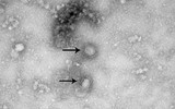 [ẢNH] Những quan niệm sai lầm về dịch viêm phổi do virus corona